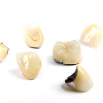 A series of dental crowns.