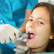 Child having tooth removed