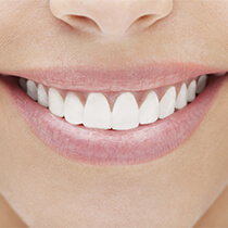 Astoria Cosmetic Dentist lady with pearly white teeth