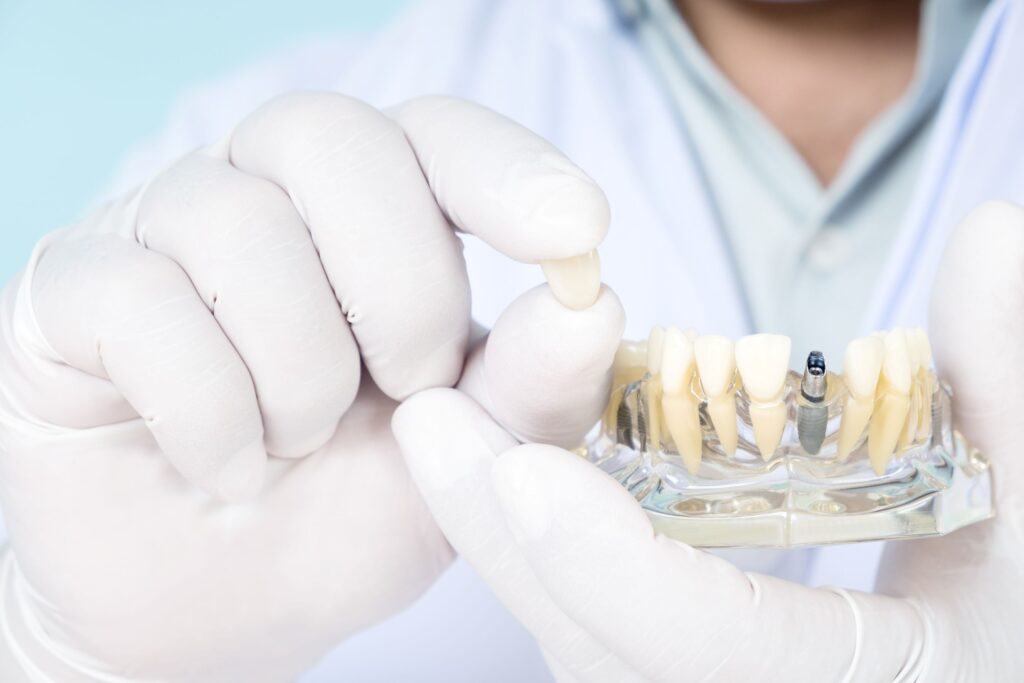 Dentist in white gloves and coat holding sample dental implant in clear base